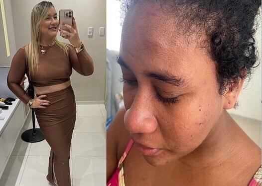 Empregada doméstica grávida diz que foi agredida fisicamente pela patroa em Paço do Lumiar-MA